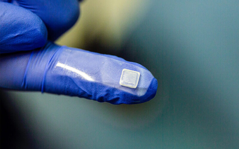 Ερευνητές από το Πανεπιστήμιο του Τορόντο κατασκεύασαν το πρώτο δερματικό επίθεμα που έχει τη δυνατότητα να αποτρέπει την υπογλυκαιμία σε άτομα με διαβήτη