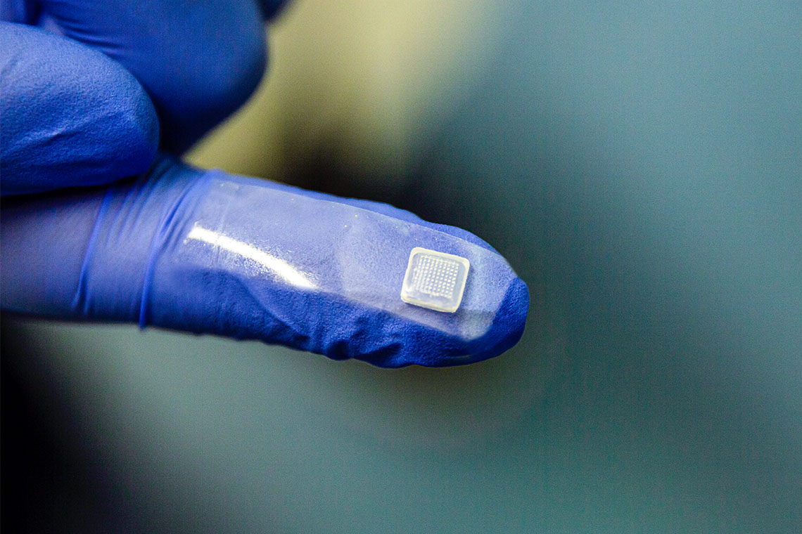 Ερευνητές από το Πανεπιστήμιο του Τορόντο κατασκεύασαν το πρώτο δερματικό επίθεμα που έχει τη δυνατότητα να αποτρέπει την υπογλυκαιμία σε άτομα με διαβήτη