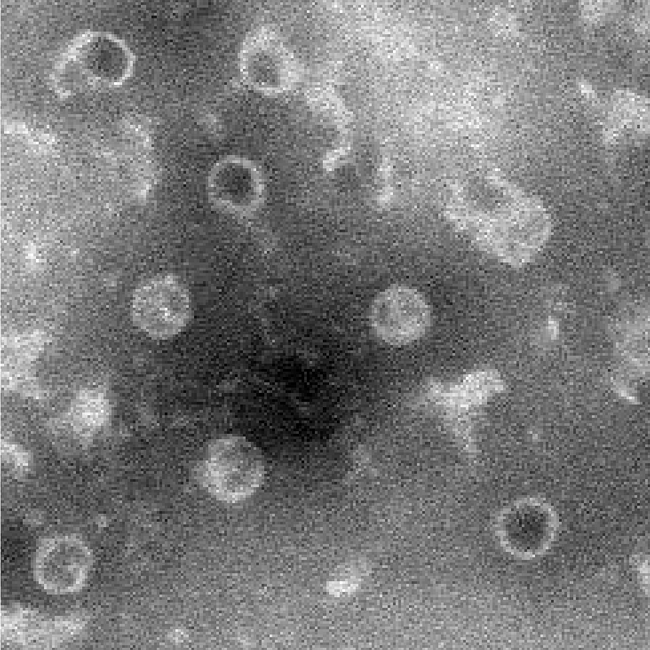 Ο Coxsackievirus B (CVB) στο μικροσκόπιο