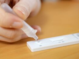 Από Παρασκευή 9 Απριλίου αναμένεται να ξεκινήσει από τα φαρμακεία η διάθεση των self tests για κορωνοϊό