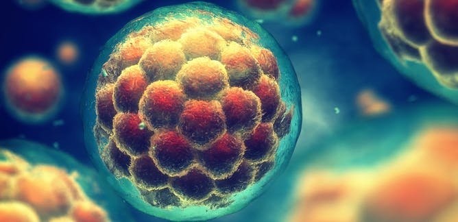 Θετικά αποτελέσματα από τις δοκιμές της νέας θεραπείας με βλαστοκύτταρα της Vertex