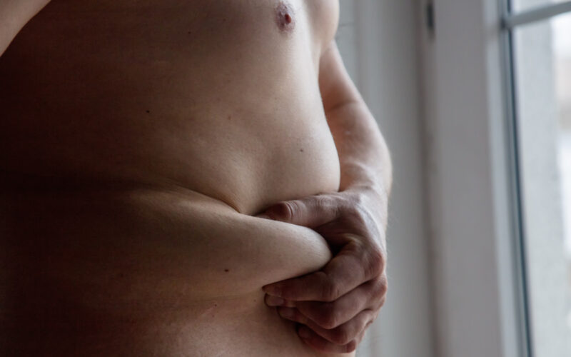Παχυσαρκία ποσοστά Ελλάδα