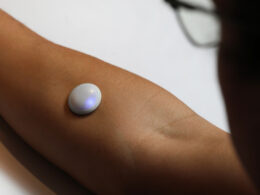 Biolinq Shine: Νέος αισθητήρας που δεν απαιτεί βελόνα για τη μέτρηση της γλυκόζης