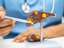 Νέο υποψήφιο φάρμακο αντιστρέφει τη μεταβολική ηπατική νόσο και την ίνωση, δείχνουν προκλινικά δεδομένα