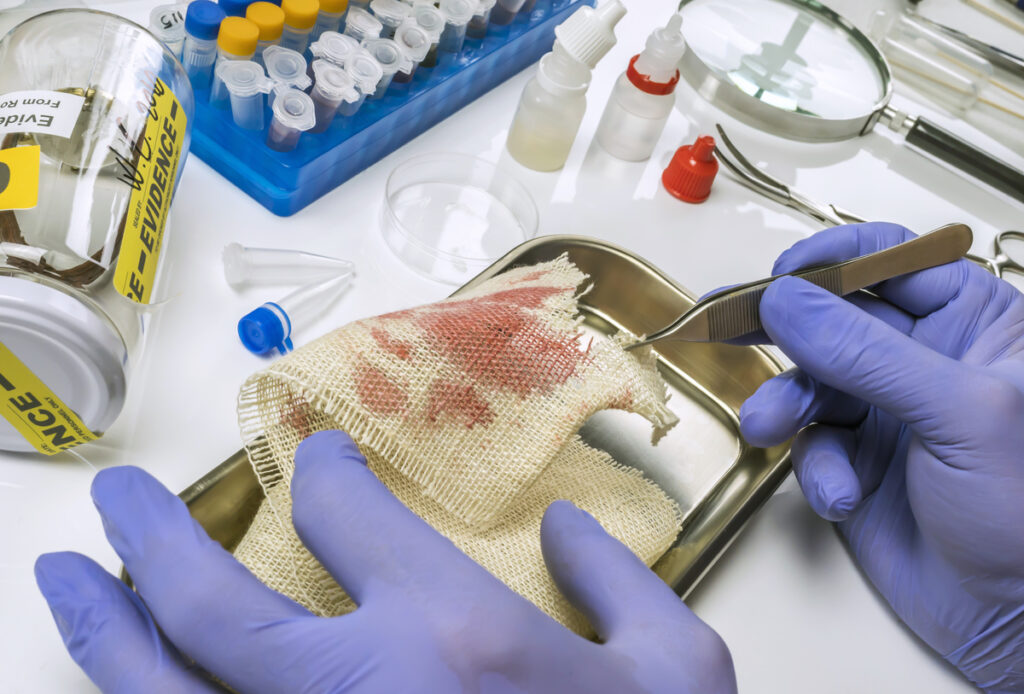 Νέα θεραπεία για διαβητικά τραύματα μετατρέπει τα κύτταρα σε επισκευαστές