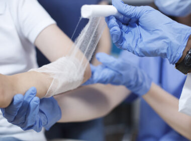 Νέα θεραπεία για διαβητικά τραύματα μετατρέπει τα κύτταρα σε επισκευαστές