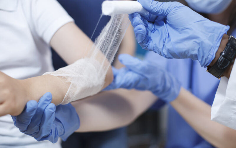 Νέα θεραπεία για διαβητικά τραύματα μετατρέπει τα κύτταρα σε επισκευαστές